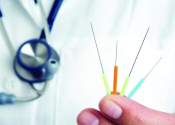 الحكومة تتجه لتنظيم مهن المعالجة بالحجامة والأعشاب والإبر الصينية