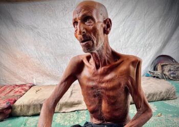 الجوع ينهش جسده.. الثمانيني سليم عصفور يصارع المجاعة في غزة