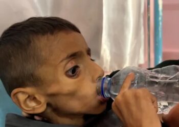 مأساة غزة تزداد: أكثر من 100 طفل يفقدون حياتهم بسبب الجوع وسوء التغذية