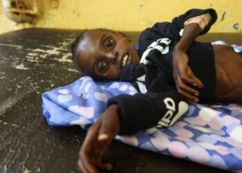 الأمم المتحدة : جوع في الفاشر وأطفال الخرطوم جلد على عظم