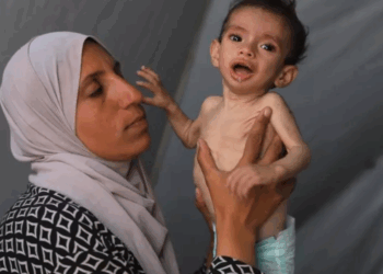 303 حالات وفاة في غزة من ضمنها 117 طفلا بسبب الجوع