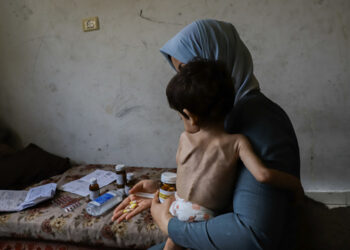 التجويع يفتك بأطفال غزة.. والأمم المتحدة تستعد لإعلان المجاعة رسمياً