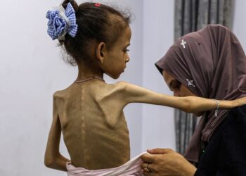 صحة غزة: 11 وفاة جديدة نتيجة المجاعة وسوء التغذية خلال الـ 24 ساعة الماضية
