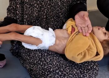 تحذير أممي من استشهاد 132 ألف طفل جوعا في غزة خلال 3أشهر