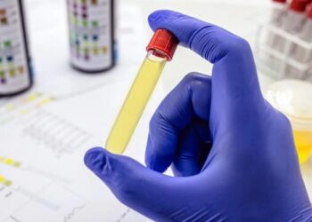 النائب المعادات يطالب بإجراء فحص تعاطي المخدرات لطلبة الجامعات
