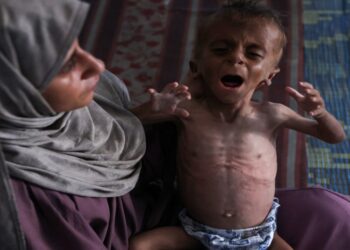 الأونروا : أسوأ سيناريوهات المجاعة يتحقق حاليا في قطاع غزة