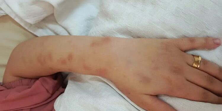 وفاة أردنية إثر تعرضها للتعذيب والضرب على يد زوجها