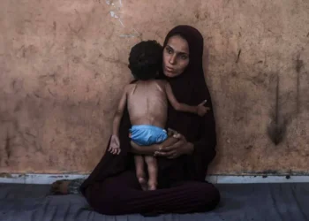 الصحة العالمية: 100 ألف طفل بغزة معرضون لسوء تغذية حاد