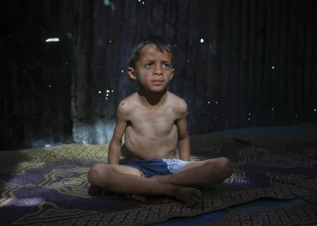 أطباء بلا حدود: مستويات مقلقة من سوء التغذية في غزة