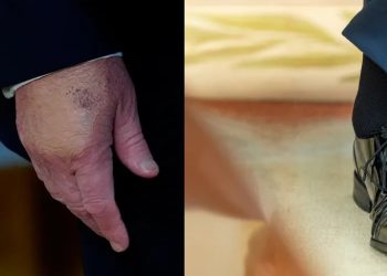تساؤلات متصاعدة حول صحة ترمب والبيت الأبيض يتمسك بالسرية