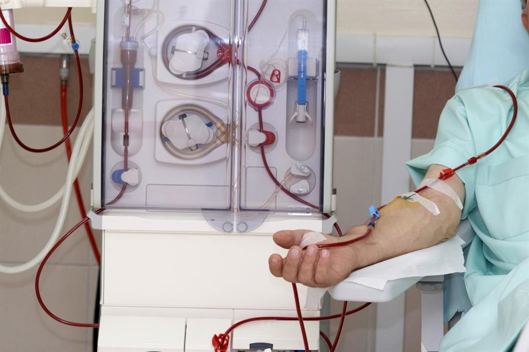 الصحة تنقل 96 مريض غسيل كلى من مستشفى خاص بعد خلل بوحدة مياه