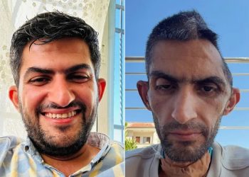 صورة الصحافي مجاهد بني مفلح تفضح آثار السجن الإسرائيلي