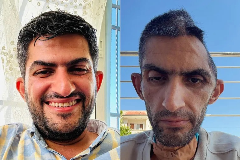 صورة الصحافي مجاهد بني مفلح تفضح آثار السجن الإسرائيلي