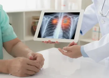 لماذا يُصاب بعض المدخنين بالسرطان وينجو آخرون؟