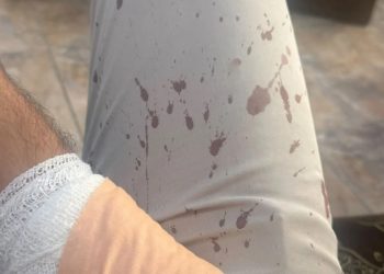طالب يعتدي على معلم بـ منشار في الزرقاء